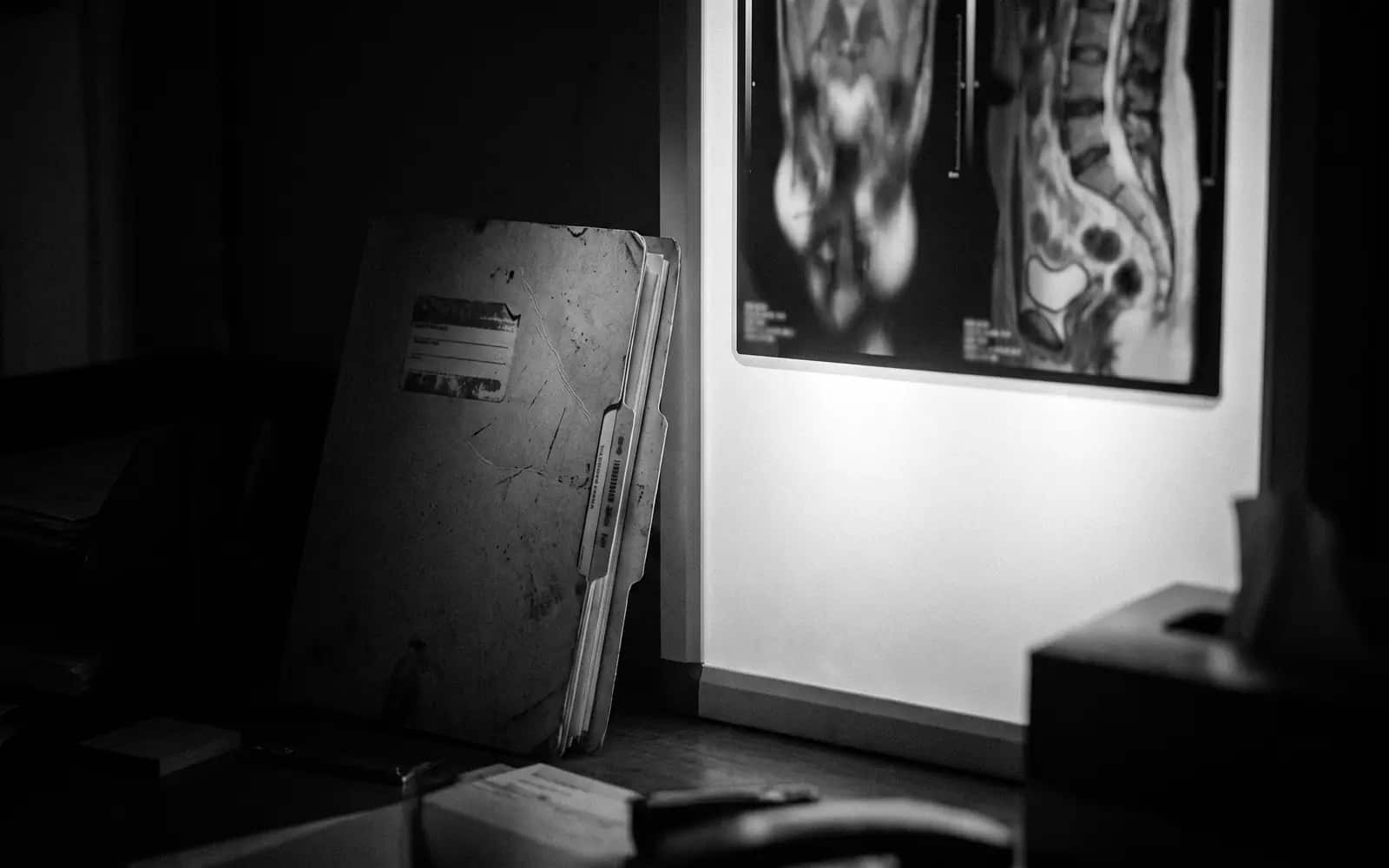 Medical records and an MRI film on a light box